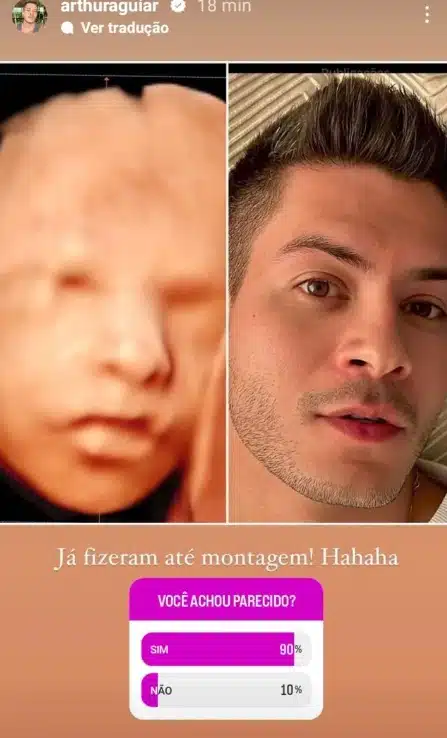 Arthur Aguiar encantou ao mostrar o rosto do seu bebê