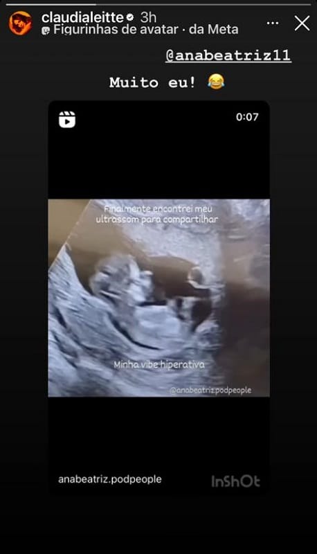 Claudia Leitte divertiu os fãs com um vídeo de ultrassom