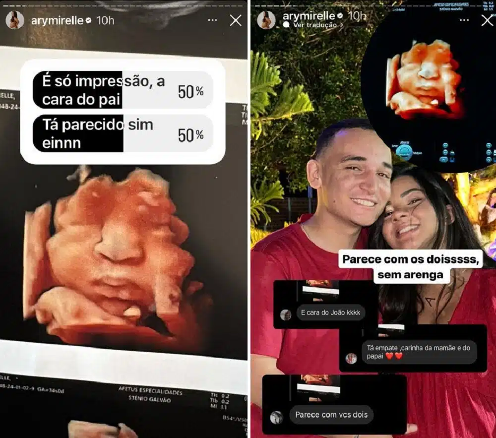 Ary Mirelle e João Gomes mostraram o rostinho do bebê e compararam com quem ele mais se parece