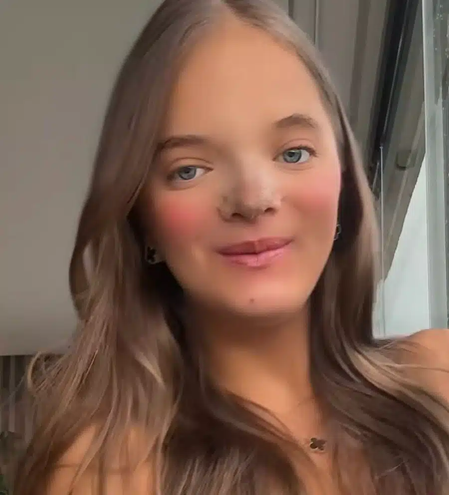 Tessian Pinheiro's daughter reveals her face after surgery
