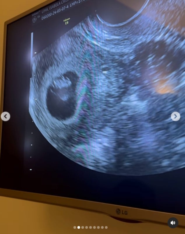 Iza mostra o ultrassom de seu bebê e encanta 