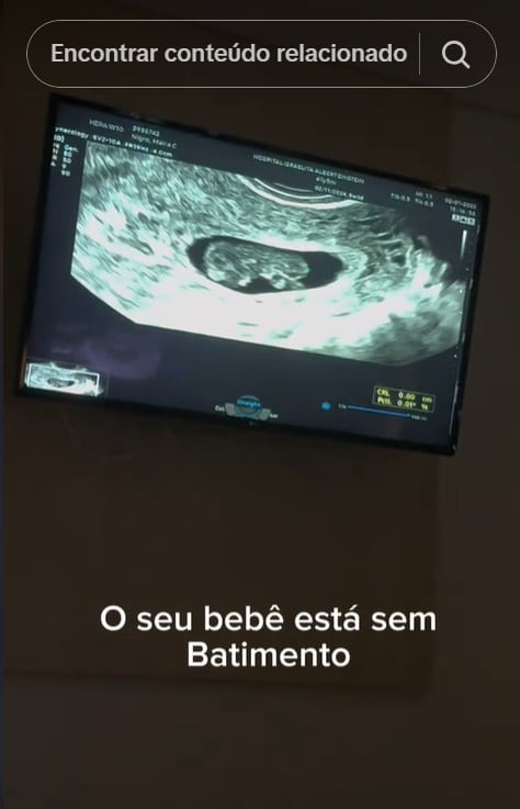 Maíra Cardi descobriu a perda do bebê que esperava