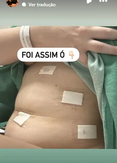 Isabel Veloso mostrando como está depois de operar