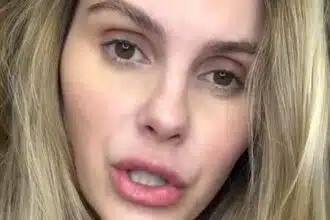 Bárbara Evans revela que seu bebê foi picado por um escorpião e desabafa