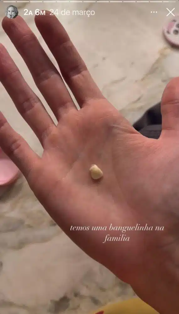 A cozinheira Isa Scherer revelou que sua bebê ficou banguela