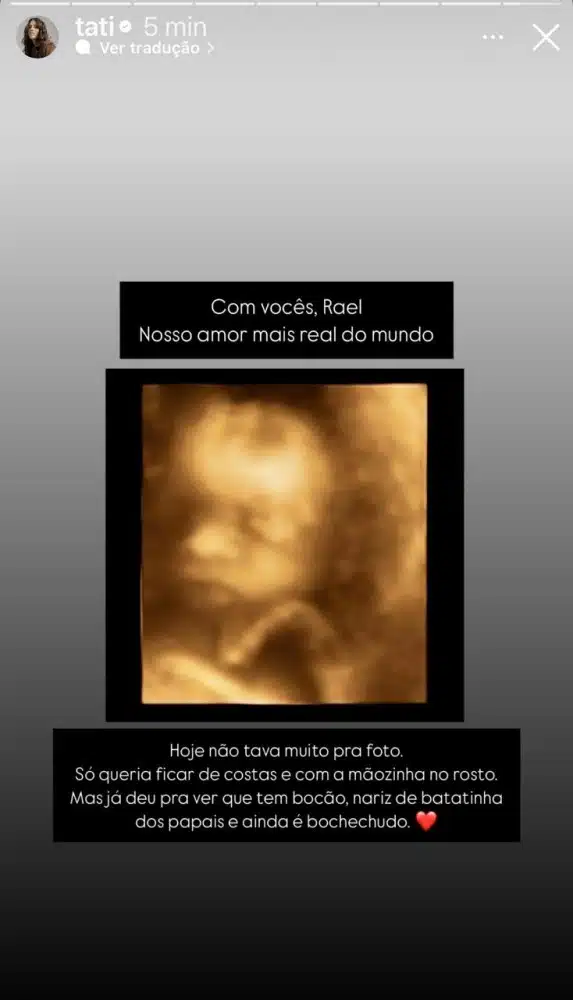 Tati Machado apresenta seu bebê e mostra o rostinho dele em imagem de ultrassom