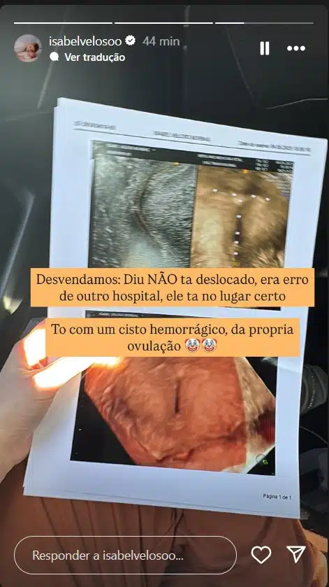 Isabel Veloso revela diagnostico do seu estado de saúde e impressiona 