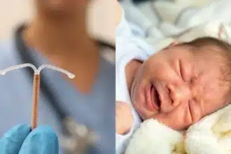 Bebê pegou todos de surpresa ao nascer com o DIU de sua mãe