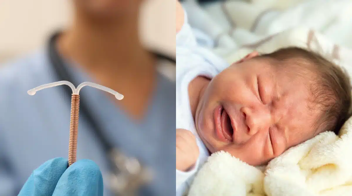 Bebê pegou todos de surpresa ao nascer com o DIU de sua mãe
