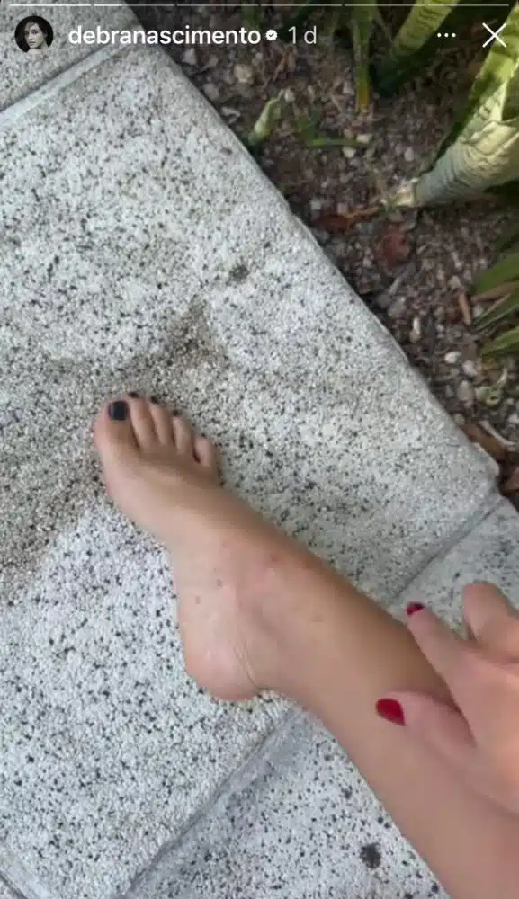 Débora Nascimento reclama de mosquitos e revela perrengue