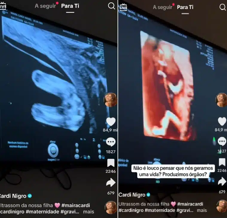 Maíra Cardi encanta ao mostrar ultrassom do seu bebê