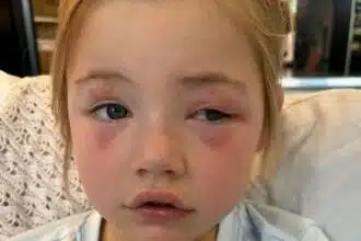 Menina perdeu a visão por causa de um item comum