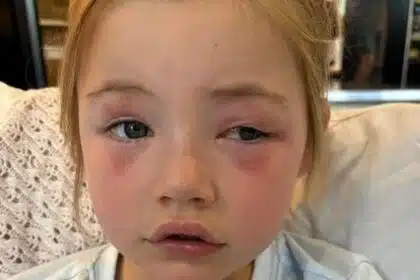 Menina perdeu a visão por causa de um item comum