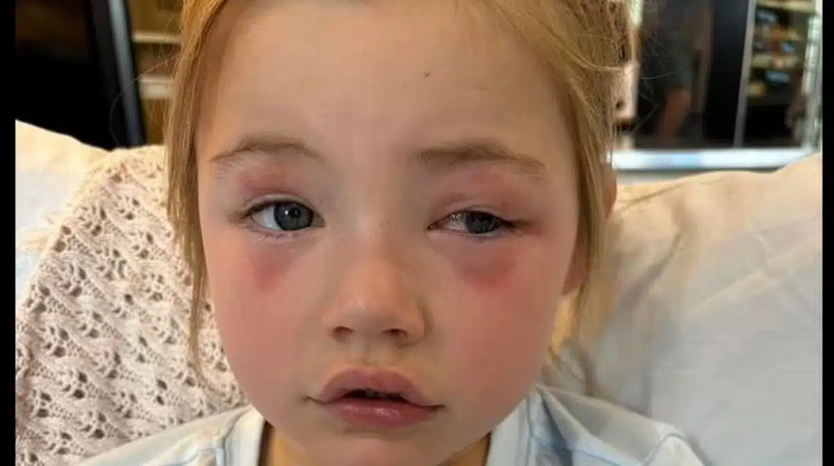Menina perdeu a visão por causa de um item comum