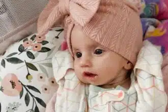 Veja o caso da bebê que não consegue sorrir