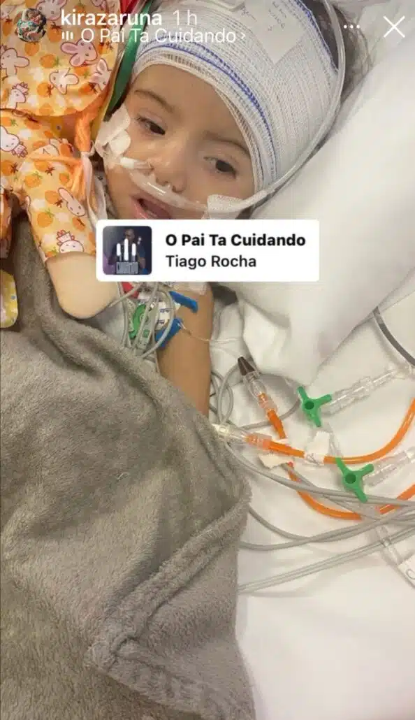 Gêmea siamesa que sobreviveu a separação de sua irmã