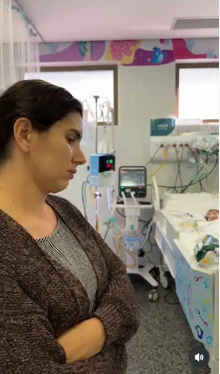 Mãe mostrou a gêmea após a cirurgia de separação