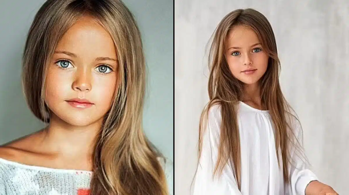 Veja o que houve com menina eleita mais bonita do mundo