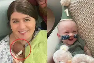 Bebê mais prematuro do mundo está comemorando seu primeiro ano