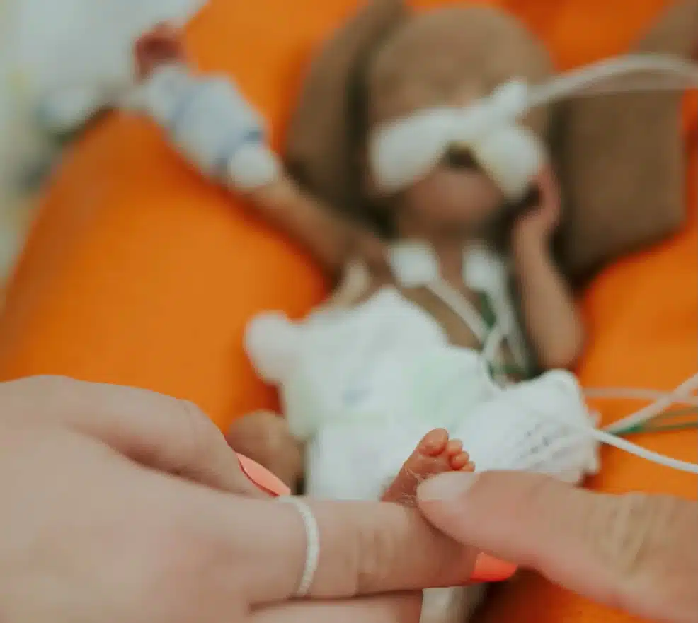 Bebê Nash Keen veio ao mundo muito prematuro
