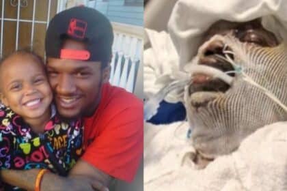 Estado de padrasto é grave, após salvar a enteada