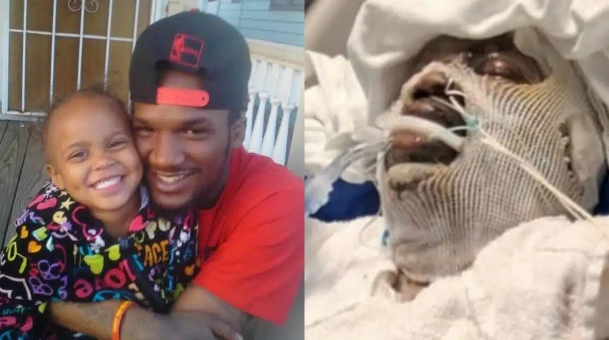 Estado de padrasto é grave, após salvar a enteada