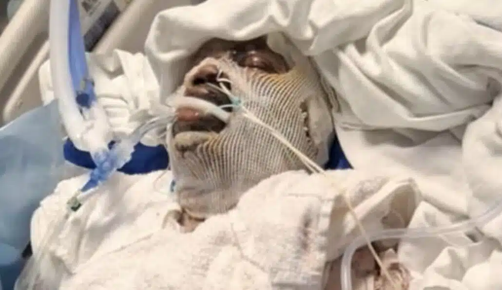 Estado do padrasto que salvou a enteada é grave