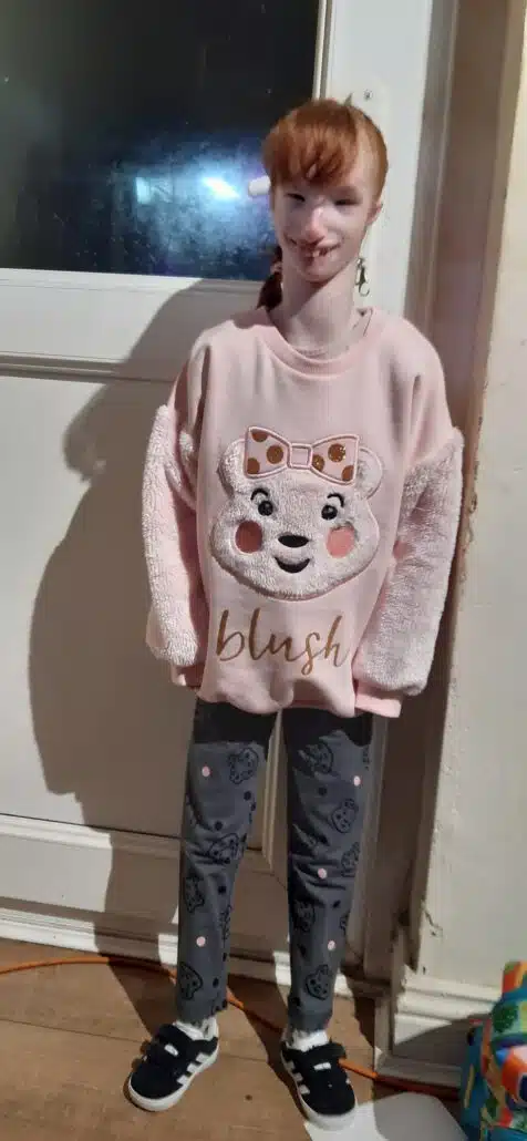 Bebê Charlotte conseguiu chegar até a adolescência