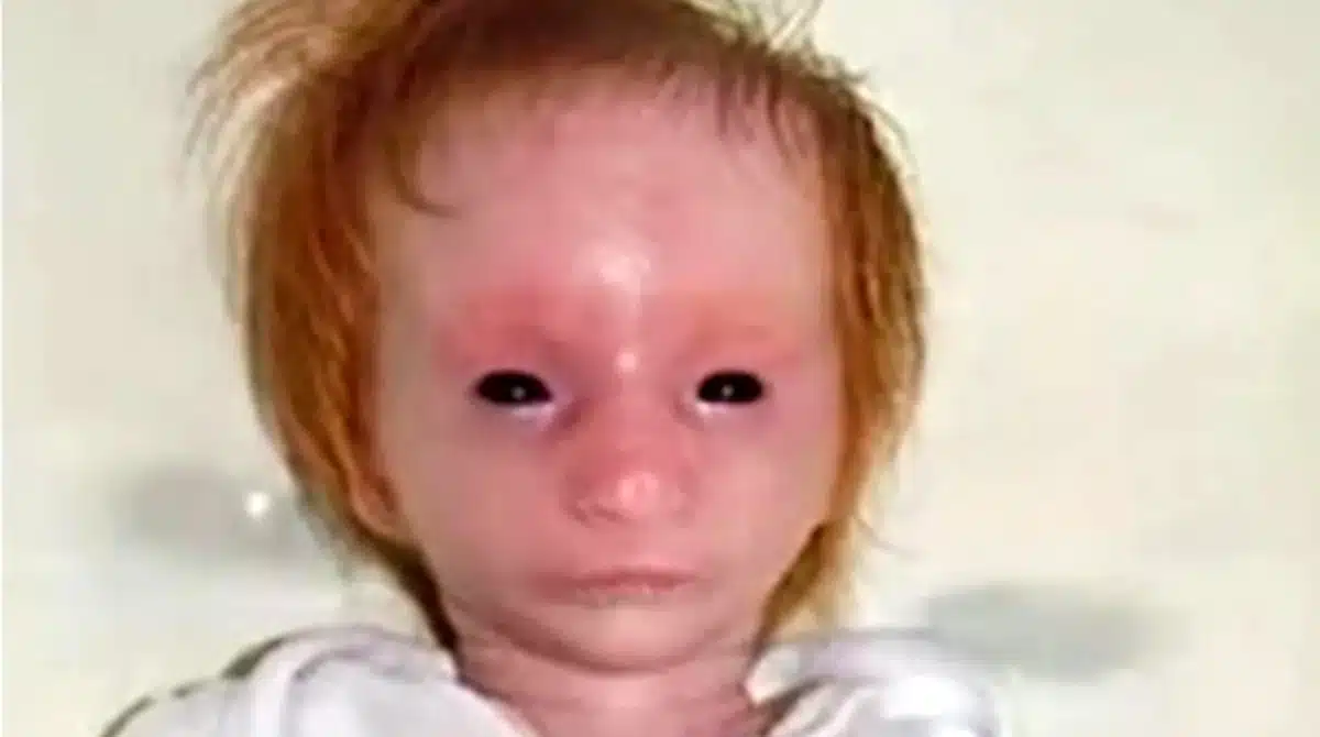 A bebê Charlotte nasceu bem pequena