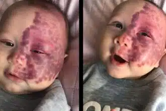 Mãe exibiu a transformação do seu bebê