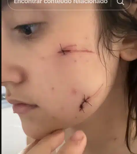 Garota Michele exibiu como seu rosto está