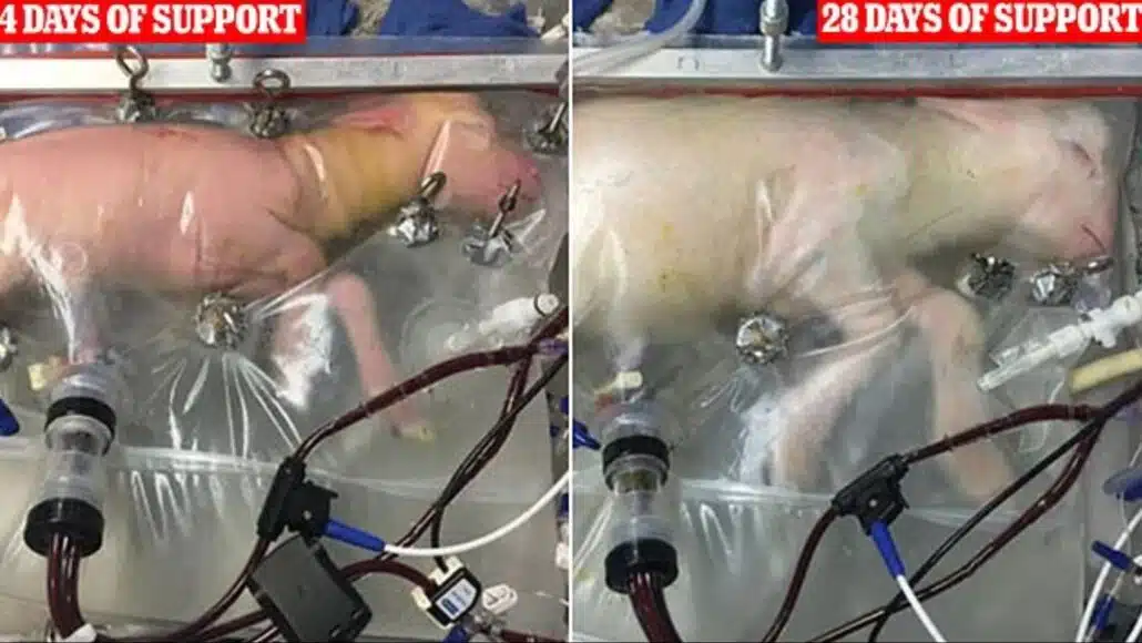 Entenda se robô grávida é possibilidade ou não