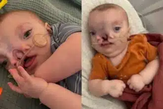 Bebê Brody terá que passar por uma grande mudança