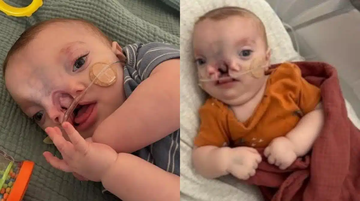 Bebê Brody terá que passar por uma grande mudança