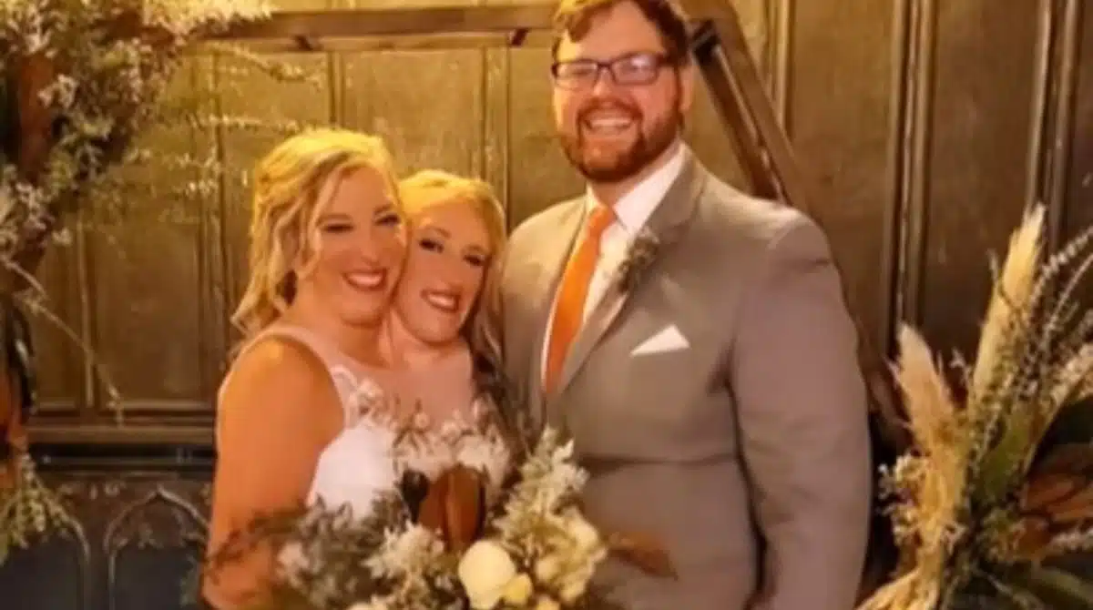 Marido das gêmeas siamesas falou pela primeira vez