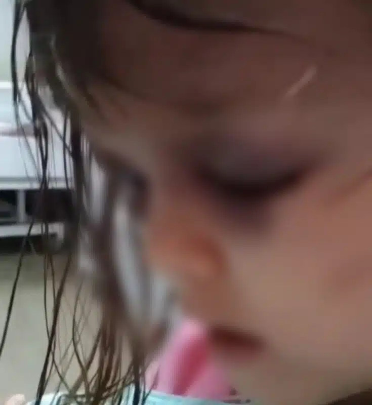 Menina após o ocorrido, mãe tentou acobertar o padrasto