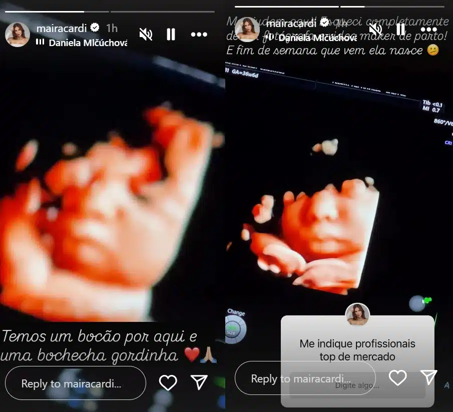 Maira Cardi mostra rosto de sua bebê e revela decisão sobre o nascimento dela e surpreende