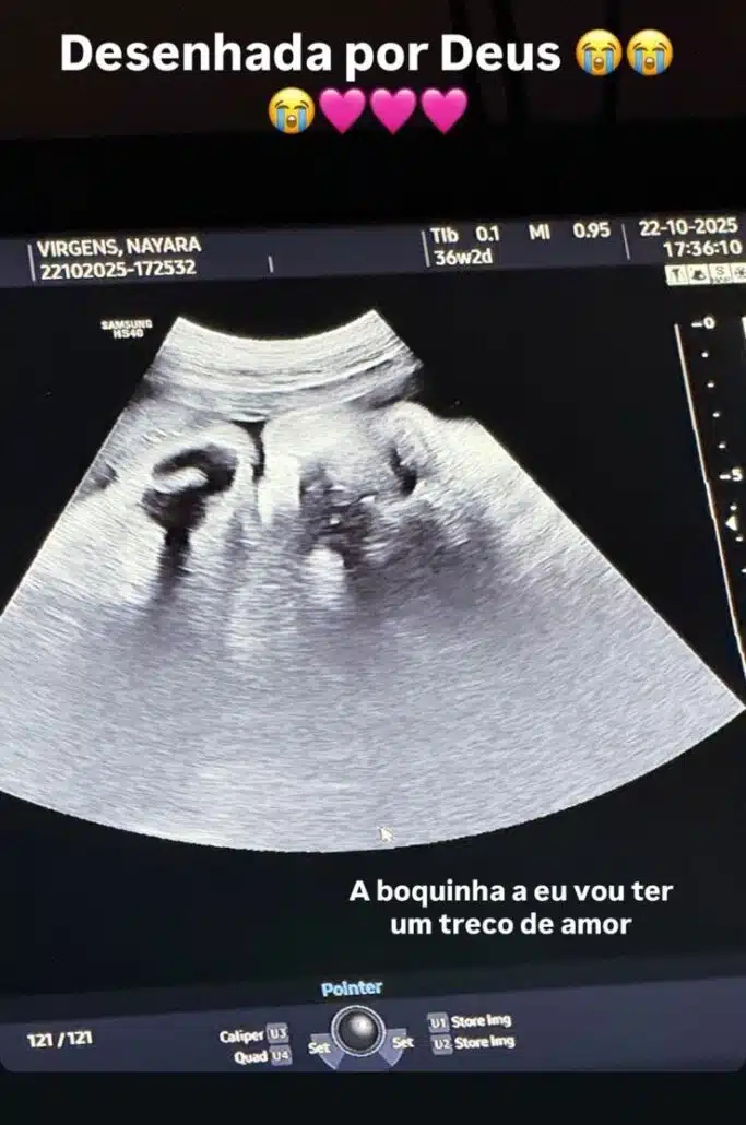 Any Awuada exibiu a filha no ultrassom