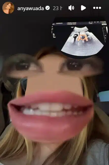 Any Awuada explicando o ultrassom de sua filha