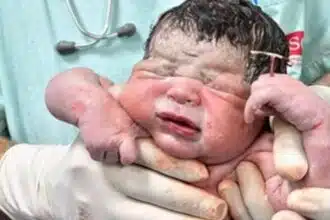 Bebê segurando o DIU de sua mãe após o nascimento