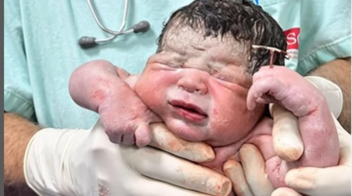 Bebês ganham decoração natalina em hospital no DF; veja fotos – Noticias R7, image size:1200x670