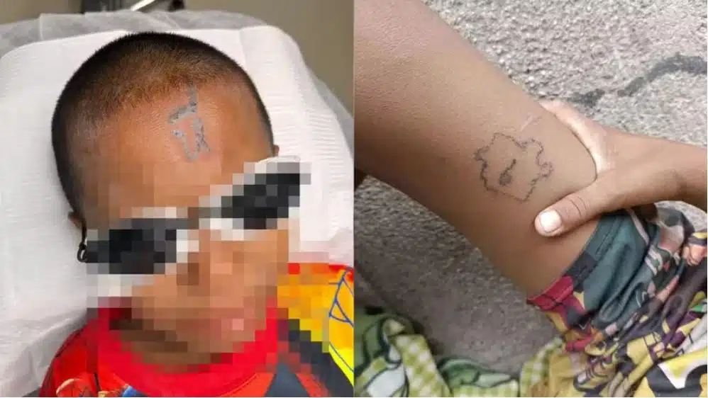 Garoto de 10 anos teve tatuagem feita por colegas