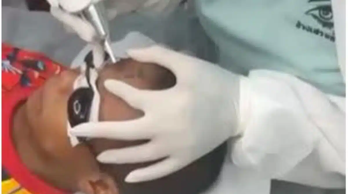 Garoto de 10 anos precisou remover uma tatuagem