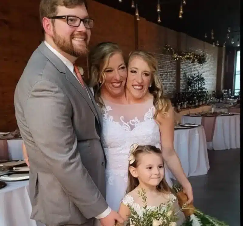 As gêmeas siamesas em seu casamento