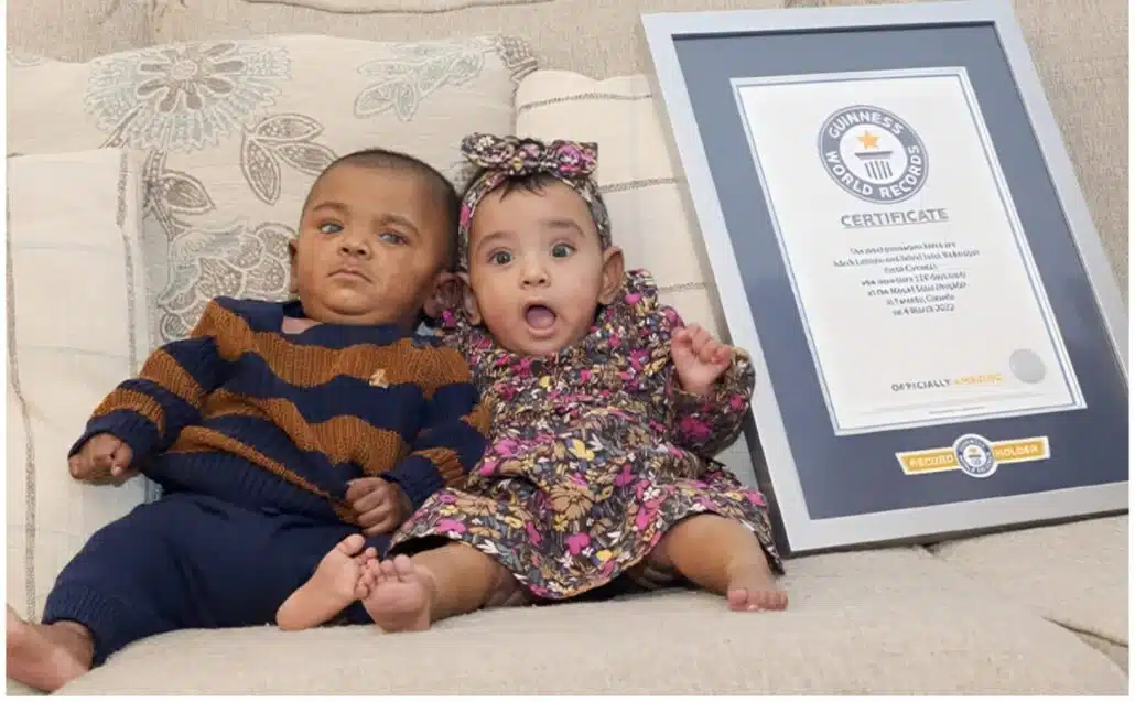 Os gêmeos pouco após terem recebido sua alta
