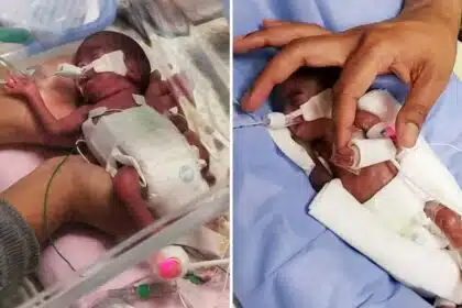 Gêmeos mais prematuros do mundo comemoraram seu terceiro aniversário