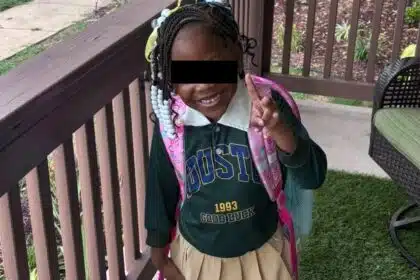 Veio à tona decisão sobre crianças que deixaram esta menina irreconhecível