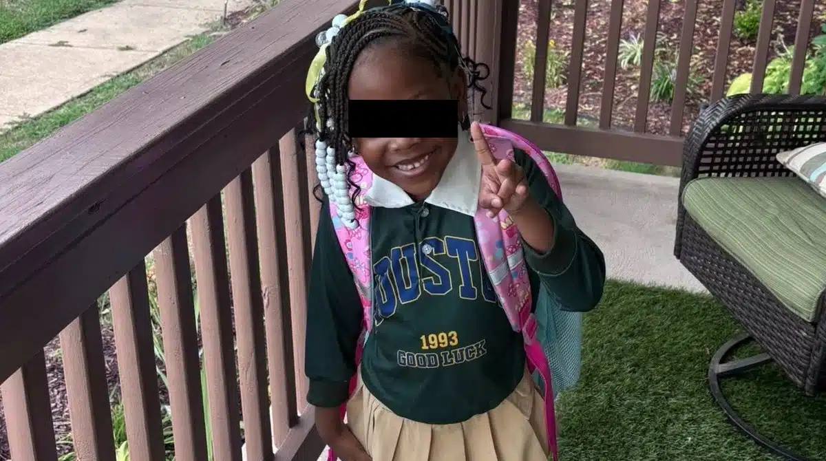 Veio à tona decisão sobre crianças que deixaram esta menina irreconhecível