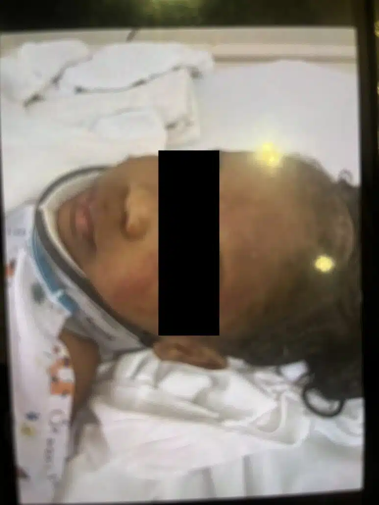 Menina de 5 anos pouco depois do ocorrido