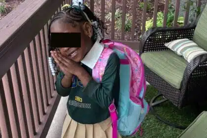 Meninos deixaram esta criança irreconhecível